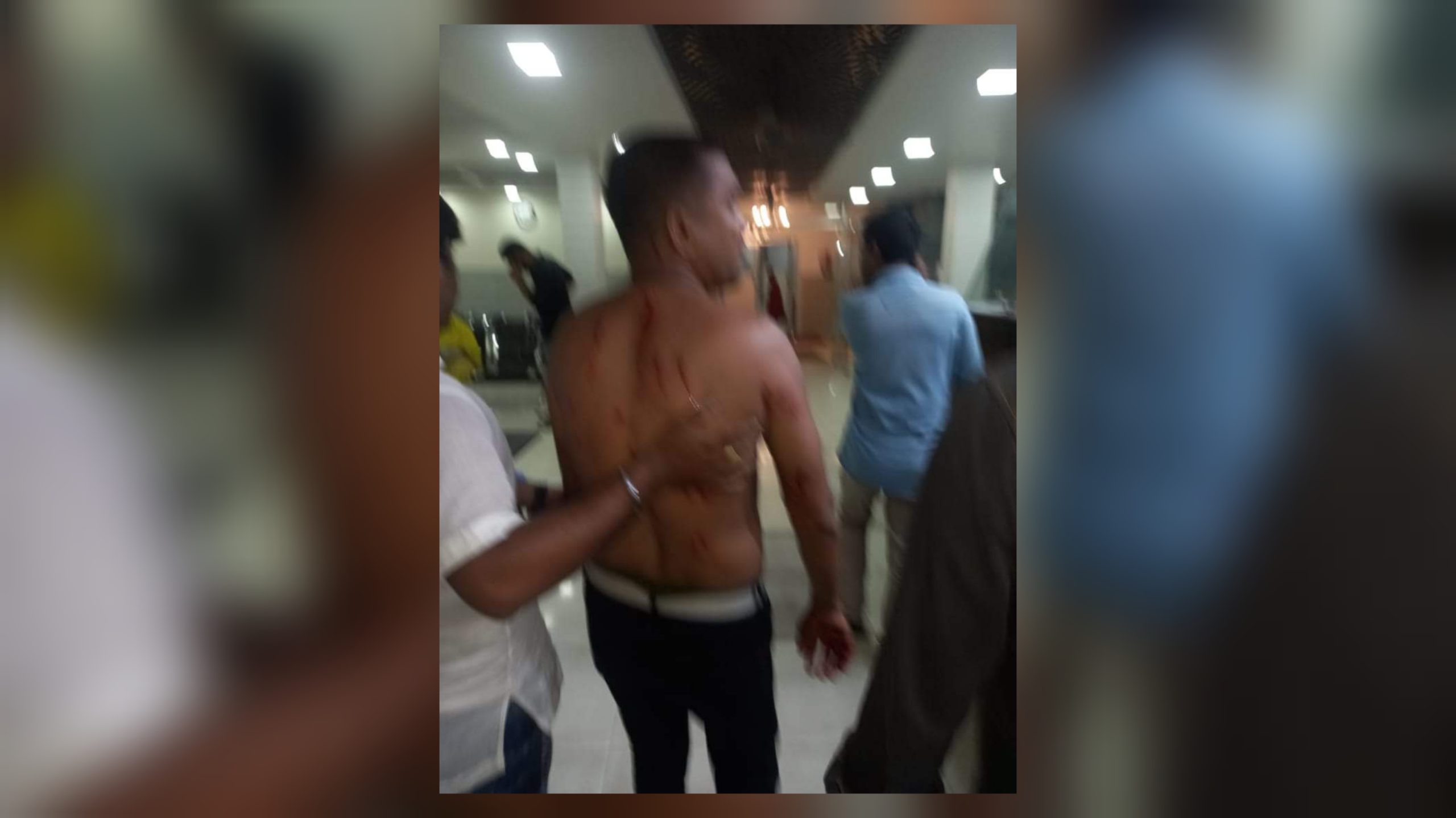 পটিয়ায়  ৩ যুবলীগ নেতা গুলিবিদ্ধ