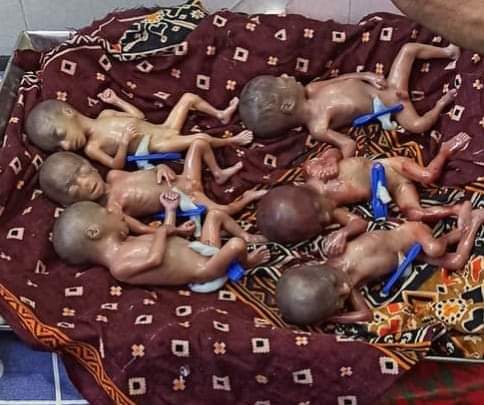 ফটিকছড়িতে একসাথে ৬ সন্তানের জম্ম দিলেন মা