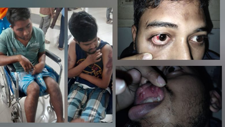 চমেকের ৪ শিক্ষার্থীকে ছাত্রলীগের নির্যাতন, ৯ সদস্যের তদন্ত কমিটি