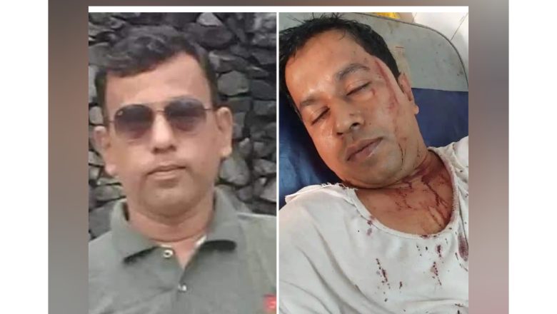 ফটিকছড়িতে স্বেচ্ছাসেবক দল নেতার বাড়িতে সন্ত্রাসী হামলা,দুই প্রবাসী ভাইকে কুপিয়ে জখম