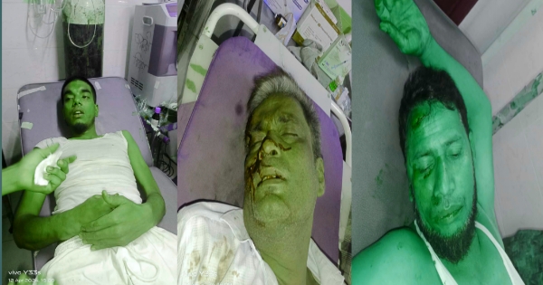 ফটিকছড়ির বাগানবাজারে ‘সাজু- রুস্তম’ গ্রুপের সংঘর্ষে আহত ২০