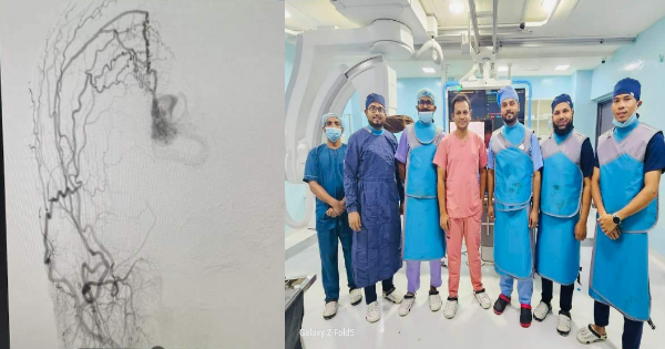 চট্টগ্রামে পার্কভিউ হসপিটালে প্রথম মস্তিষ্কের এঞ্জিওগ্রাম সফলভাবে সম্পন্ন