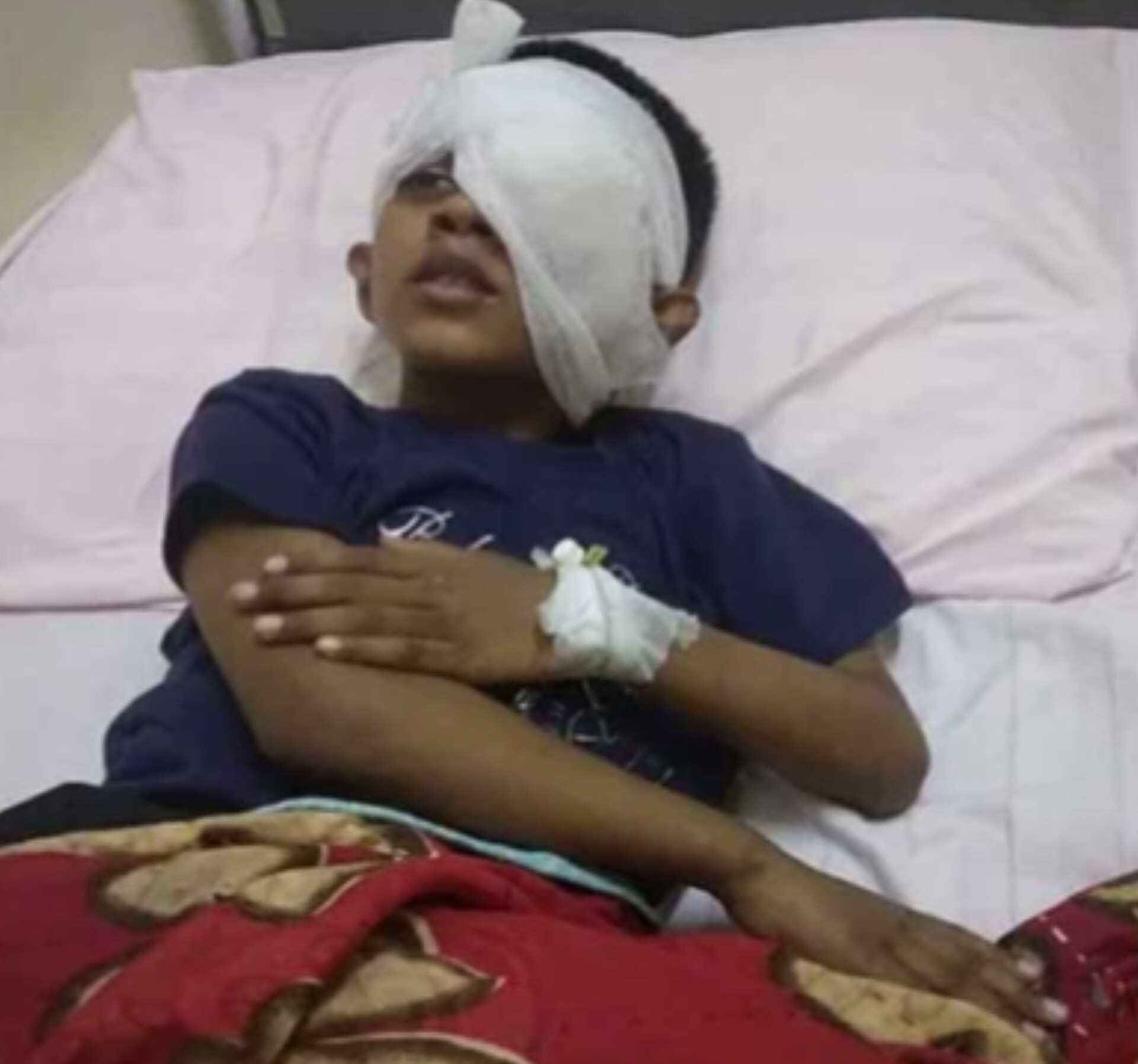 বোয়ালখালীতে  শিক্ষার্থীকে পিটিয়ে চোখ নষ্ট করার অভিযোগ