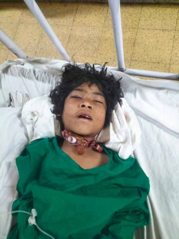 সফল অস্ত্রোপচার শেষে ৭২ ঘণ্টার পর্যবেক্ষণে শিশু ইরামণি, ধর্ষণের রিপোর্টে নজর